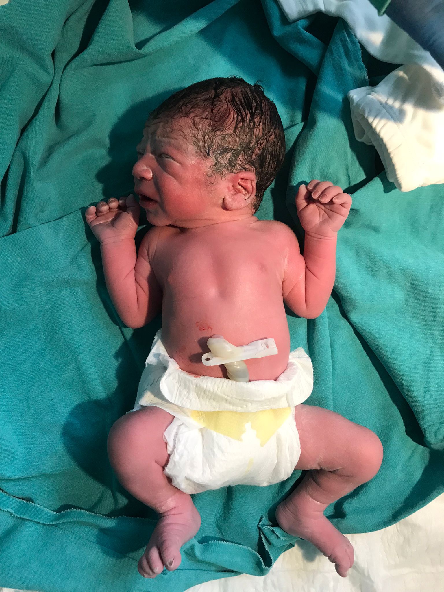 Kıbrıs Tüp Bebek Merkezi başarı hikâyesi bebek fotoğrafı 34 — galeri fotoğrafı